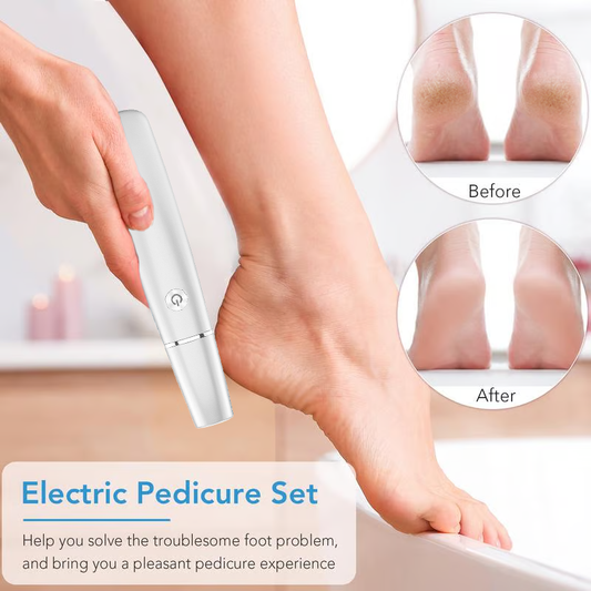 🏆Last Day Sale - Only ￡9.99!🔥Flash Sale⚡50K+ SOLD!💥💕Electric Feet Callus Remover🎁1 * Replacement Head Included